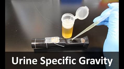 refractometer specific gravity urine principle|specific gravity refractometer urine low.